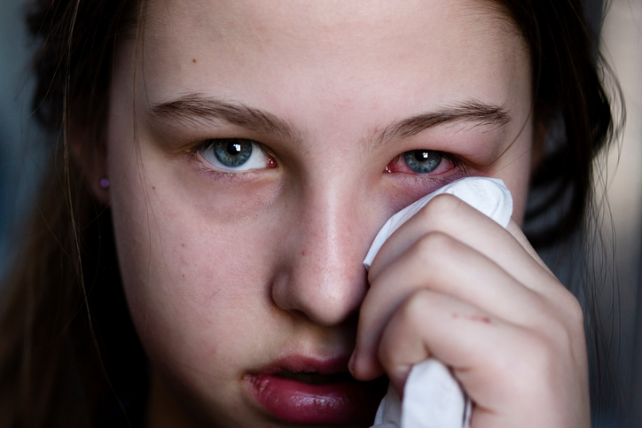 Dívka má oteklé a bolestivé oko, možná je i alergie